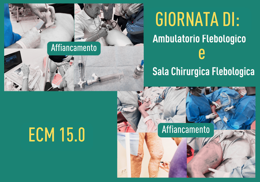 GIORNATA IN sala flebologica E AMB FLEBO