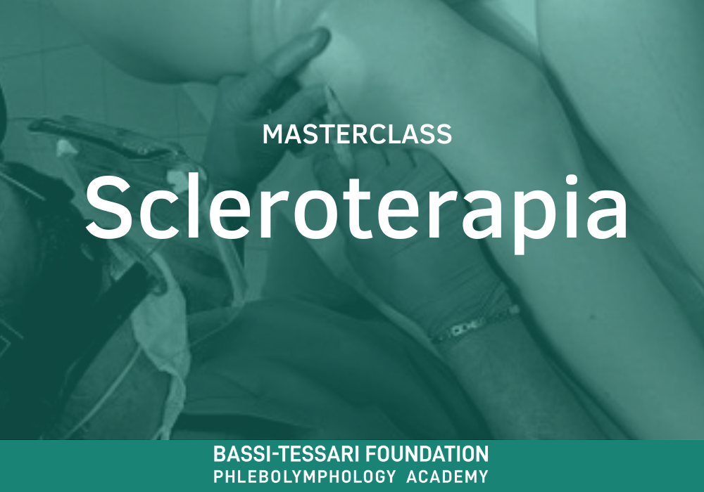 scleroterapia