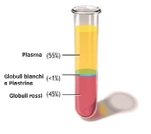 Plasma